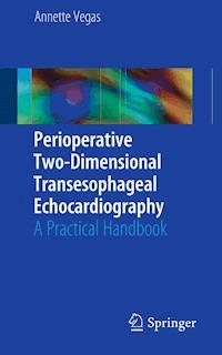 Perioperative Two-Dimensional Transesophageal Echocardiography - Annette Vegas - ebook