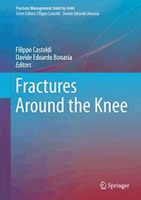 Fractures Around the Knee - - ebook