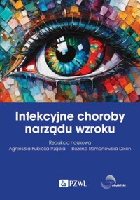 Infekcyjne choroby narządu wzroku - Bożena Romanowska-Dixon, Agnieszka Kubicka-Trząska - książka