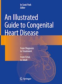An Illustrated Guide to Congenital Heart Disease -  - ebook