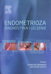 Endometrioza diagnostyka i leczenie -  - książka