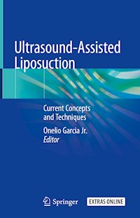 Ultrasound-Assisted Liposuction -  - ebook