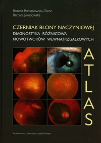 Czerniak błony naczyniowej Diagnostyka różnicowa nowotworów wewnątrzgałkowych - Romanowska-Dixon Bożena, Jakubowska Barbara - książka