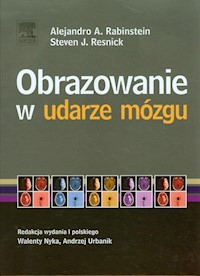Obrazowanie w udarze mózgu - Rabinstein Alejandro A., Resnick Steven J. - książka