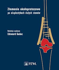 Złamania okołoprotezowe po aloplastykach dużych stawów - Golec Edward - książka