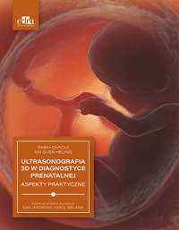 Ultrasonografia 3D w diagnostyce prenatalnej - R. Chaoui - książka