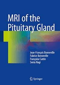 MRI of the Pituitary Gland - Jean-François Bonneville - ebook