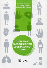 Ostre stany zagrożenia życia w obrażeniach ciała - praca zbiorowa - książka