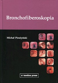 Bronchofiberoskopia - Pirożyński Michał - książka