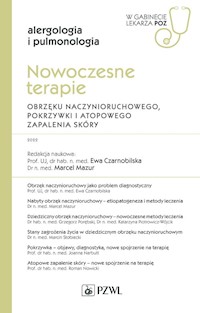 Nowoczesne terapie obrzęku naczynioruchowego, pokrzywki i atopowego zapalenia skóry. - Czarnobilska Ewa, Mazur Marcel - książka