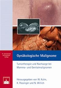 Gynäkologische Malignome -  - ebook