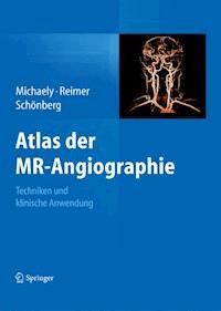 Atlas der MR-Angiographie - - ebook