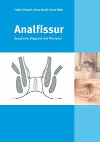 Analfissur - Franz Raulf - ebook