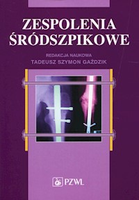 Zespolenia śródszpikowe -  - książka