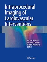 Intraprocedural Imaging of Cardiovascular Interventions -  - ebook