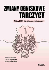 Zmiany ogniskowe tarczycy. Atlas USG dla lekarzy rodzinnych - Dorota Szydlarska, Katarzyna Życińska - książka