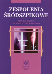 Zespolenia śródszpikowe - Tadeusz Szymon Gaździk - książka