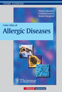Color Atlas of Allergic Diseases - Grevers Gerhard - ebook