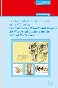 Contemporary Periodontal Surgery - Geoffrey Bateman - ebook