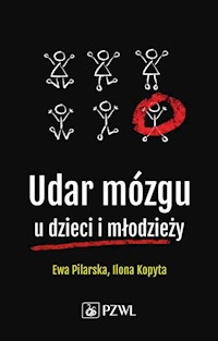 Udar mózgu u dzieci i młodzieży - Pilarska Ewa, Kopyta Ilona - książka
