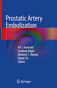 Prostatic Artery Embolization - - ebook