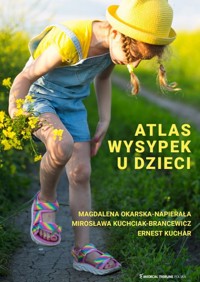 Atlas wysypek u dzieci -  - książka