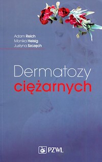 Dermatozy ciężarnych - Reich Adam, Heisig Monika, Szczęch Justyna - książka