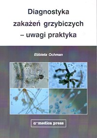 Diagnostyka zakażeń grzybiczych - uwagi praktyka - Ochman Elżbieta - książka