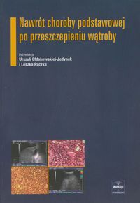 Nawrót choroby podstawowej po przeszczepieniu wątroby - , - książka