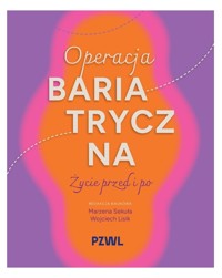 Operacja bariatryczna. Życie przed i po - Marzena Sekuła - książka
