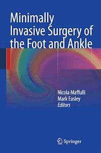 Minimally Invasive Surgery of the Foot and Ankle - - ebook