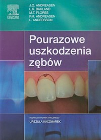 Pourazowe uszkodzenia zębów - Andreasen J.O., Bakland L.K., Flores M.T. - książka