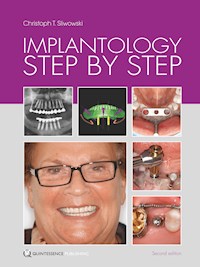 Implantology Step by Step - Christoph T. Sliwowski - ebook