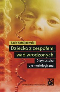 Dziecko z zespołem wad wrodzonych - Korniszewski Lech - książka
