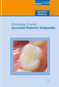Successful Posterior Composites - Christopher D. Lynch - ebook