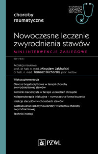 Nowoczesne leczenie zwyrodnienia stawów. Mini-interwencje zabiegowe. W gabinecie lekarza specjalisty - Tomasz Blicharski, Mirosław Jabłoński - książka