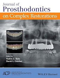 Journal of Prosthodontics on Complex Restorations - - ebook