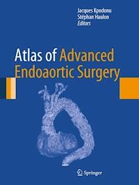 Atlas of Advanced Endoaortic Surgery - - ebook
