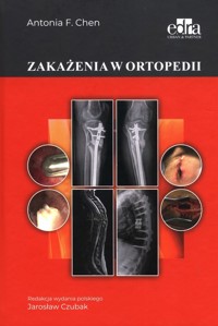 Zakażenia w ortopedii - A.F. Chen - książka