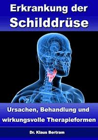 Erkrankung der Schilddrüse – Ursachen, Behandlung und wirkungsvolle Therapieformen - Dr. Klaus Bertram - ebook