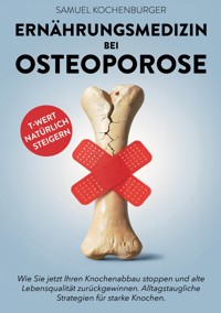 Ernährungsmedizin bei Osteoporose - Samuel Kochenburger - ebook