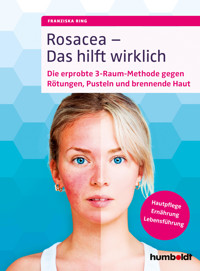 Rosacea – Das hilft wirklich - Franziska Ring - ebook