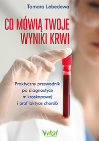 Co mówią twoje wyniki krwi. - Tamara Lebedewa - ebook