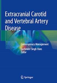 Extracranial Carotid and Vertebral Artery Disease - - ebook