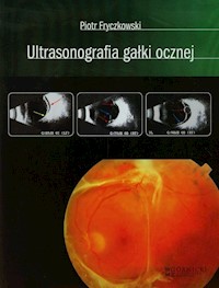 Ultrasonografia gałki ocznej - Piotr Fryczkowski - książka