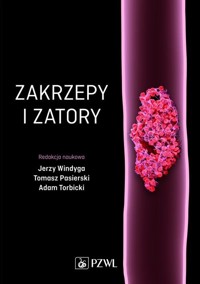 Zakrzepy i zatory - Windyga Jerzy, Pasierski Tomasz, Torbicki Adam - książka