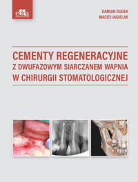 Cementy regeneracyjne z dwufazowym siarczanem wapnia w chirurgii stomatologicznej - Jagielak M., Dudek D. - książka