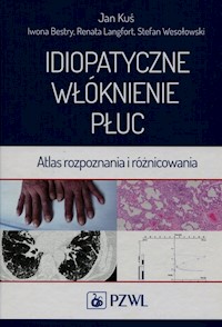Idiopatyczne włóknienie płuc - Kuś Jan, Bestry Iwona, Langfort Renata - książka