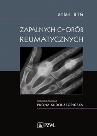 Atlas RTG zapalnych chorób reumatycznych - Iwona Sudoł-Szopińska (red.) - książka