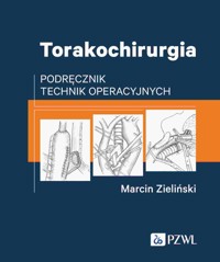 Torakochirurgia. Podręcznik technik operacyjnych - Marcin Zieliński - książka